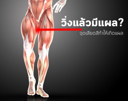 วิ่งแล้วเป็นแผลที่ขาด้านใน? 